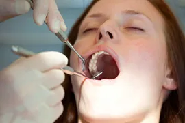 woman getting her teeth examined